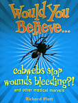 Would You Believe...Cobwebs Stop Wounds Bleeding?
